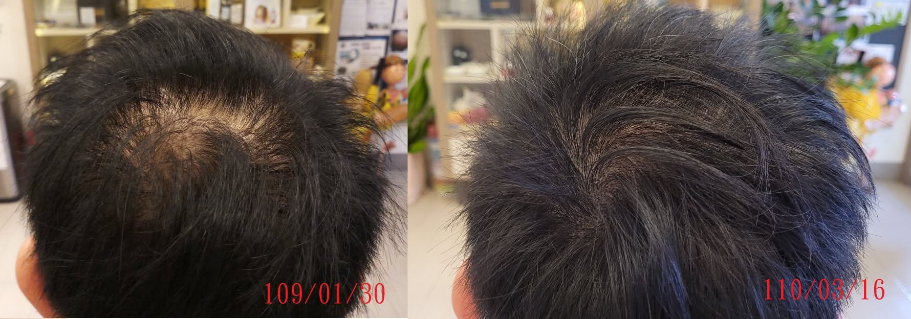 頭皮頭髮護理前後對照